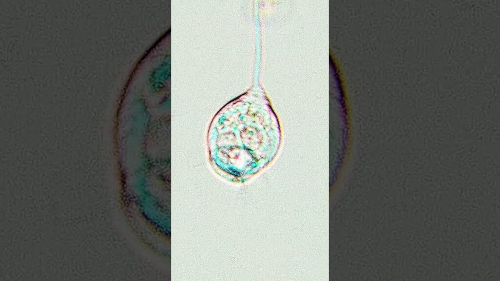 Meet Vorticella – Microscopic Marvel